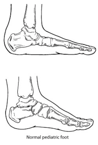 The Pediatric Foot